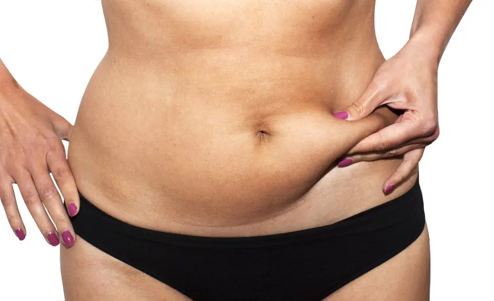 tummy-tuck-vs-liposuction