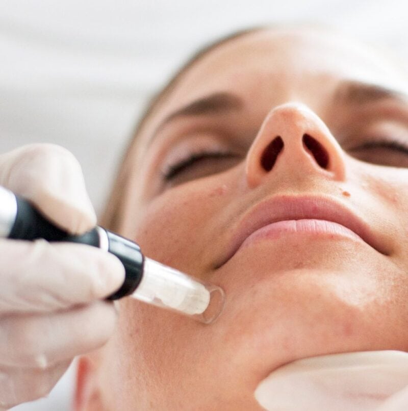 At Home Safe and Effective Microneedling Solutions